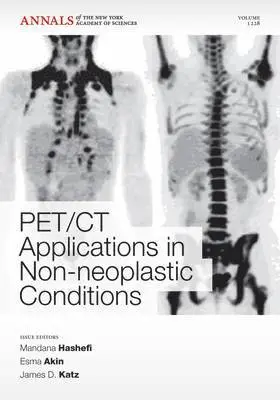 Mandana Hashefi, Esma Akin, James D. Katz - PET CT Applications in Non-Neoplastic Conditions, Volume 1228, Häftad. Tillgänglighet: Tillfälligt slut