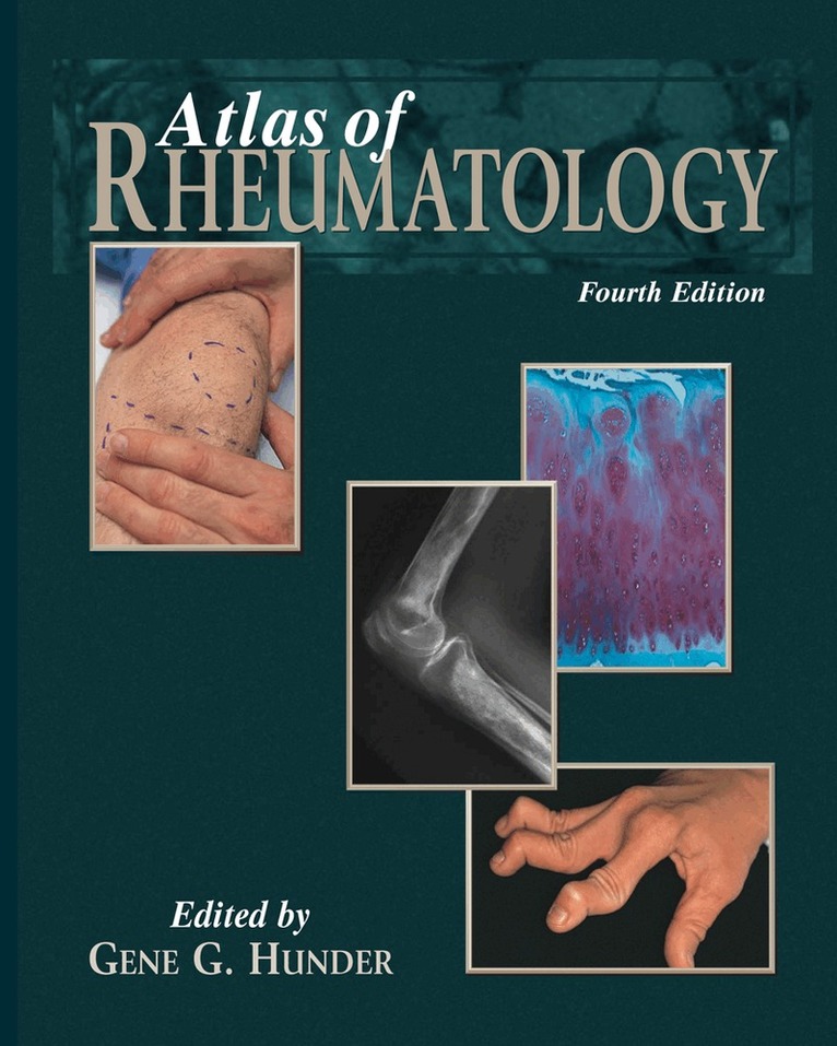 Gene G. Hunder - Atlas of Rheumatology, Inbunden