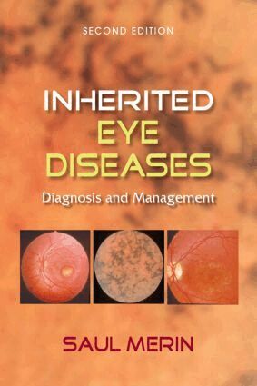 Saul Merin - Inherited Eye Diseases, Inbunden. Tillgänglighet: Lägg i varukorg