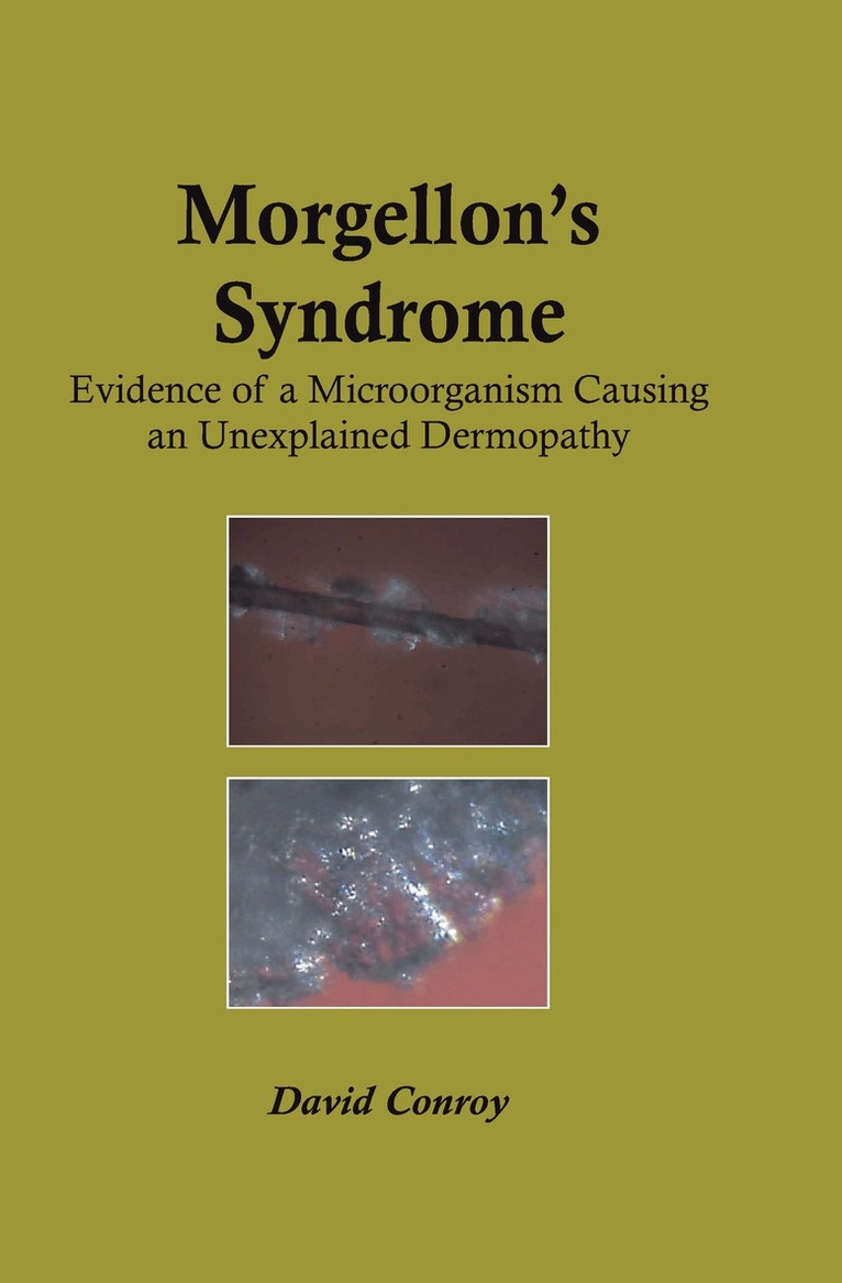 David Conroy - Morgellon's Syndrome, Häftad. Tillgänglighet: Lägg i varukorg