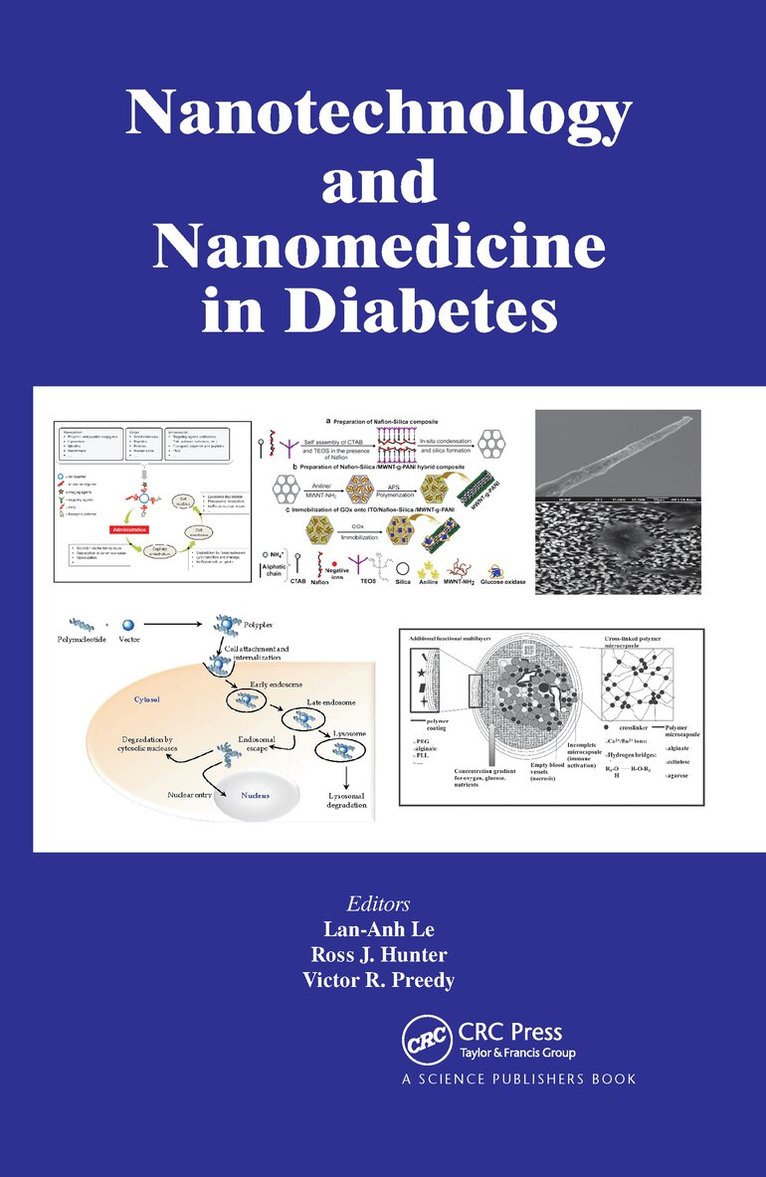 Lan-Anh Le, Ross J. Hunter, Victor R. Preedy - Nanotechnology and Nanomedicine in Diabetes, Inbunden