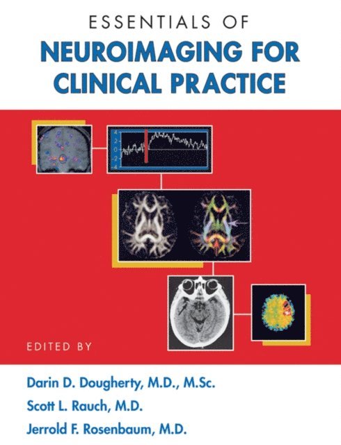 Jerrold F. Rosenbaum, Scott L. Rauch, Darin D. Dougherty - Essentials of Neuroimaging for Clinical Practice, E-bok
