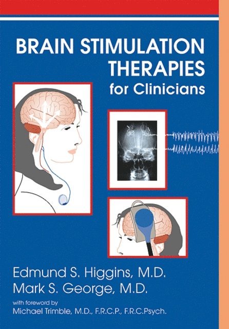Mark S. George, Edmund S. Higgins - Brain Stimulation Therapies for Clinicians, E-bok