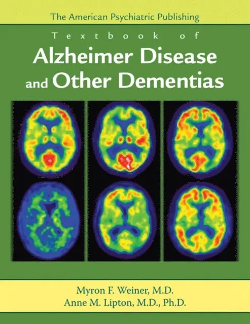 Anne M. Lipton, Myron F. Weiner - American Psychiatric Publishing Textbook of Alzheimer Disease and Other Dementias, E-bok. Tillgänglighet: Lägg i varukorg