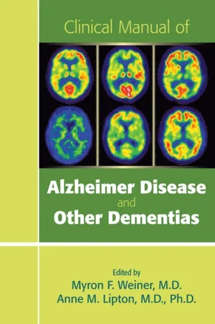 Anne M. Lipton, Myron F. Weiner - Clinical Manual of Alzheimer Disease and Other Dementias, E-bok. Tillgänglighet: Lägg i varukorg