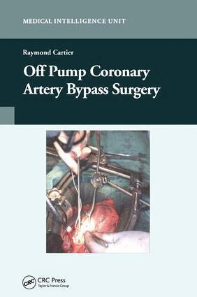 Raymond Cartier - Off-Pump Coronary Artery Bypass Surgery, Inbunden. Tillgänglighet: Tillfälligt slut