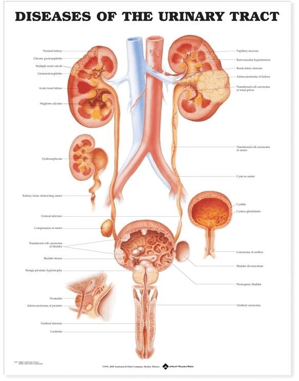 Diseases of the Urinary Tract Anatomical Chart, Övrigt
