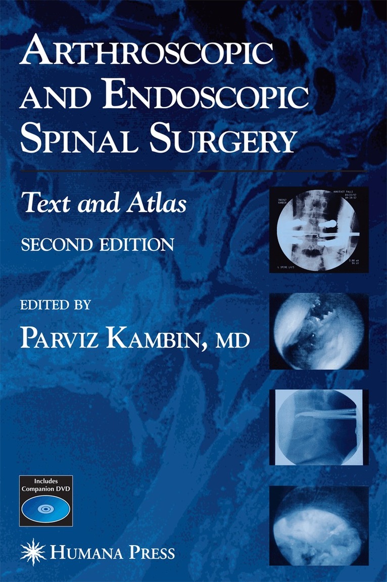 Parviz Kambin - Arthroscopic and Endoscopic Spinal Surgery, Inbunden