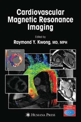 Raymond Y. Kwong - Cardiovascular Magnetic Resonance Imaging [With CDROM], Inbunden