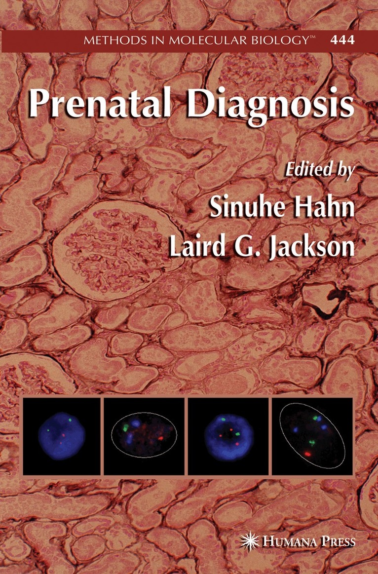 Sinuhe Hahn, Laird G. Jackson - Prenatal Diagnosis, Inbunden