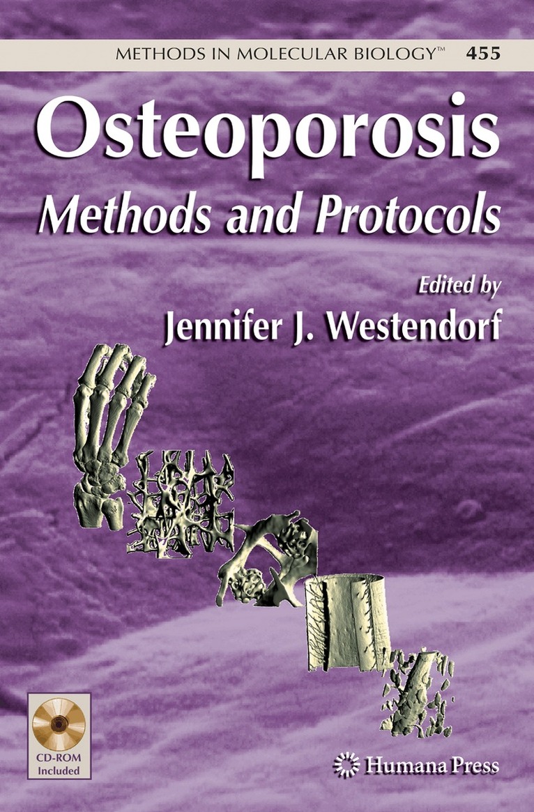 Jennifer Westendorf - Osteoporosis, Inbunden. Tillgänglighet: Lägg i varukorg