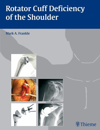 Mark Frankle - Rotator Cuff Deficiency of the Shoulder, Inbunden