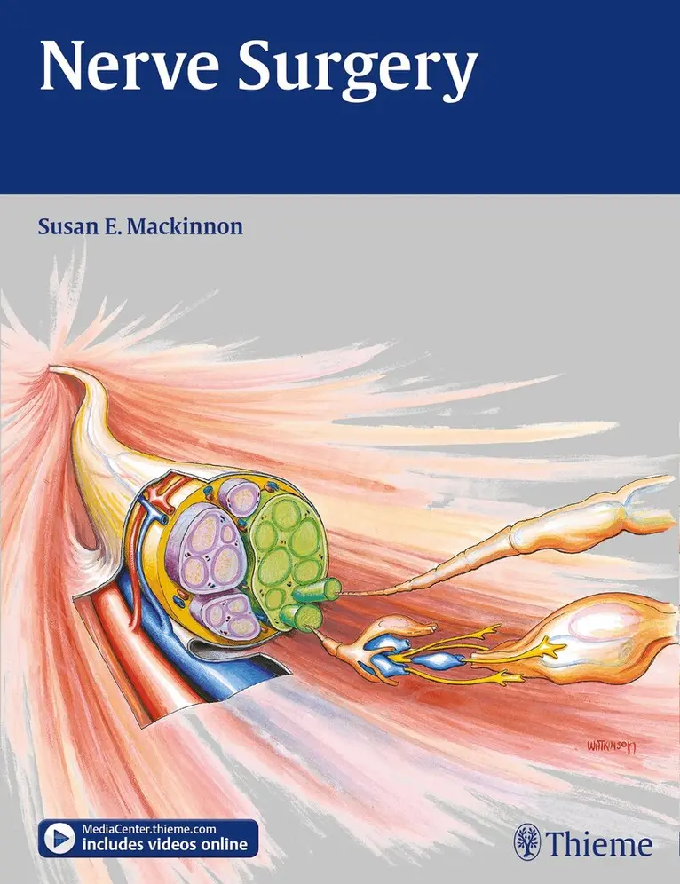Susan E. Mackinnon - Nerve Surgery, Inbunden. Tillgänglighet: Tillfälligt slut
