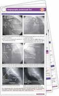 Angiography Pocketcard Set