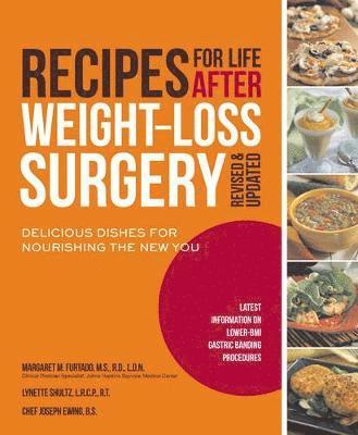 Margaret M Furtado, Lynette Schultz, Joseph Ewing - Recipes for Life After Weight-Loss Surgery, Häftad