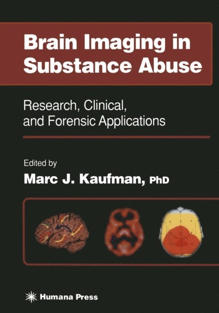 Marc J. Kaufman - Brain Imaging in Substance Abuse, E-bok