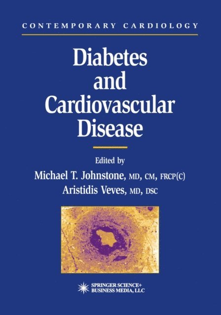 Aristidis Veves, Michael T. Johnstone - Diabetes and Cardiovascular Disease, E-bok