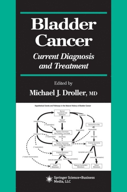 Michael J. Droller - Bladder Cancer, E-bok