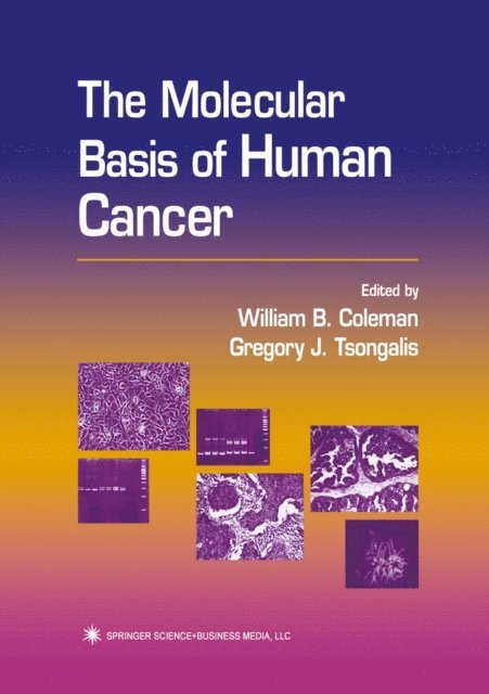 Gregory J. Tsongalis, William B. Coleman - Molecular Basis of Human Cancer, E-bok