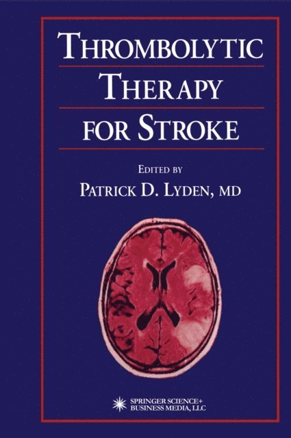 Patrick D. Lyden - Thrombolytic Therapy for Stroke, E-bok