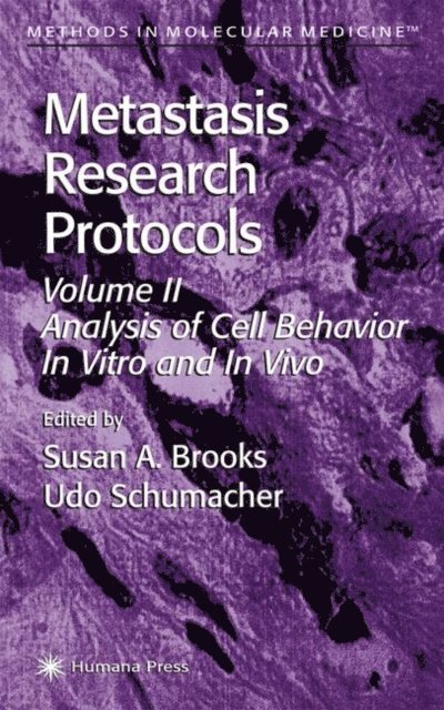 Udo Schumacher, Susan A. Brooks - Metastasis Research Protocols, E-bok