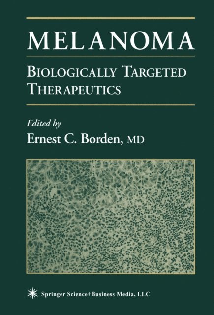 Ernest C. Borden - Melanoma, E-bok