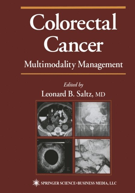 Leonard B. Saltz - Colorectal Cancer, E-bok
