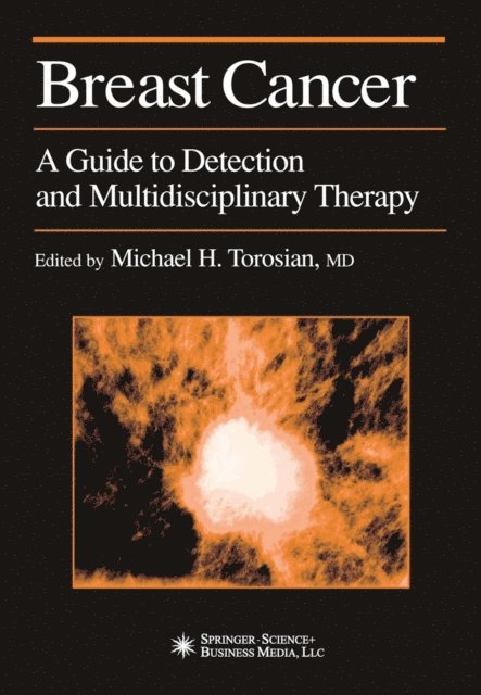 Michael H. Torosian - Breast Cancer, E-bok