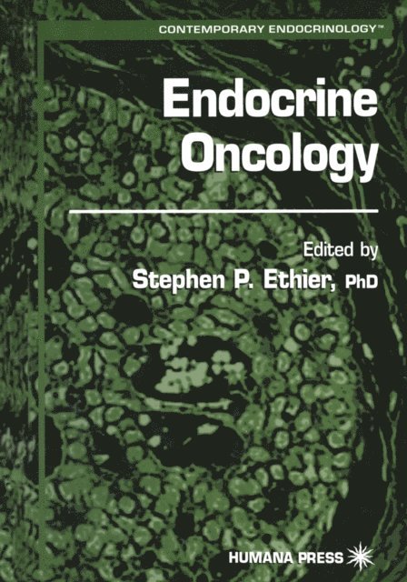 Stephen P. Ethier - Endocrine Oncology, E-bok