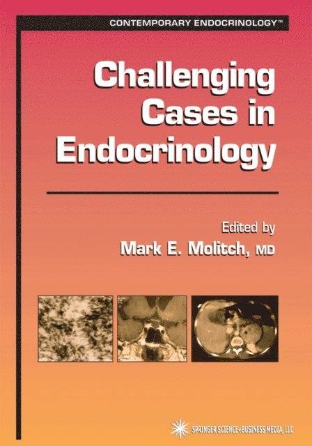 Mark E. Molitch - Challenging Cases in Endocrinology, E-bok