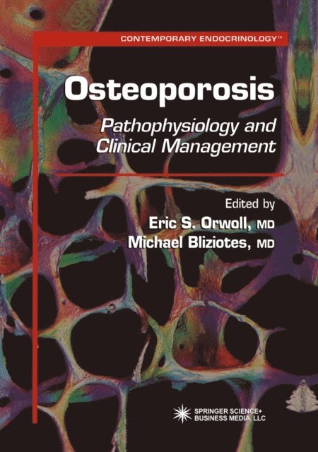 Michael Bliziotes, Eric S. Orwoll - Osteoporosis, E-bok