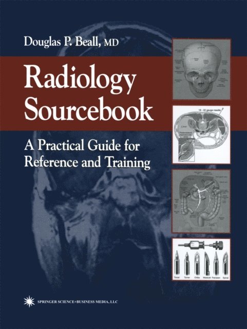 Douglas P. Beall - Radiology Sourcebook, E-bok