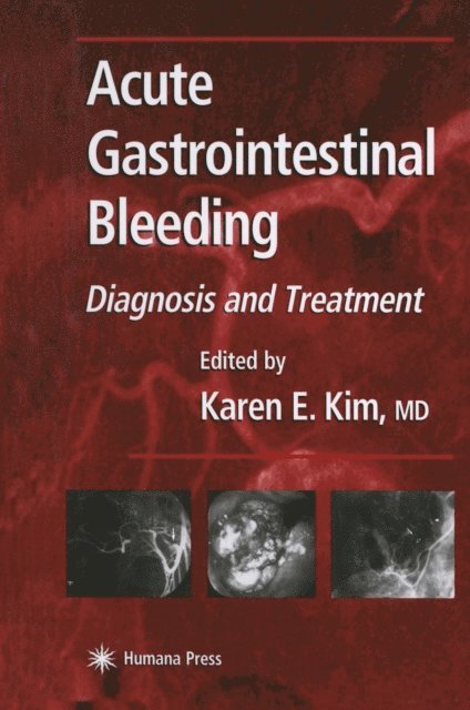 Karen E. Kim - Acute Gastrointestinal Bleeding, E-bok