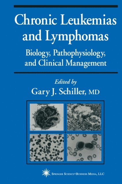 Gary J. Schiller - Chronic Leukemias and Lymphomas, E-bok