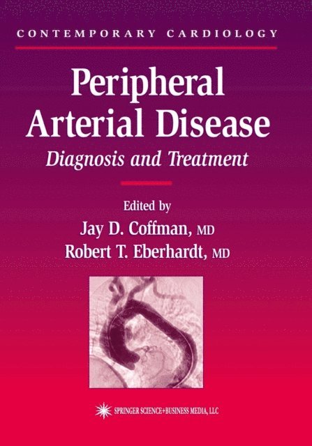 Robert T. Eberhardt, Jay D. Coffman - Peripheral Arterial Disease, E-bok