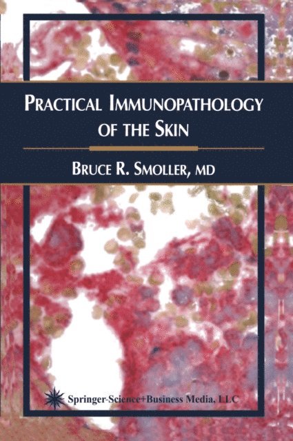 Bruce R. Smoller - Practical Immunopathology of the Skin, E-bok