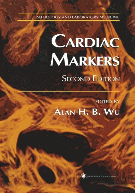 Alan H. B. Wu - Cardiac Markers, E-bok