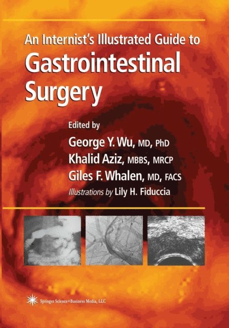 George Y. Wu - Internist's Illustrated Guide to Gastrointestinal Surgery, E-bok
