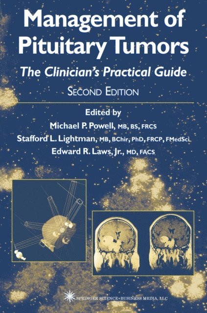 Edward R. Laws Jr., Stafford L. Lightman, Michael P. Powell - Management of Pituitary Tumors, E-bok