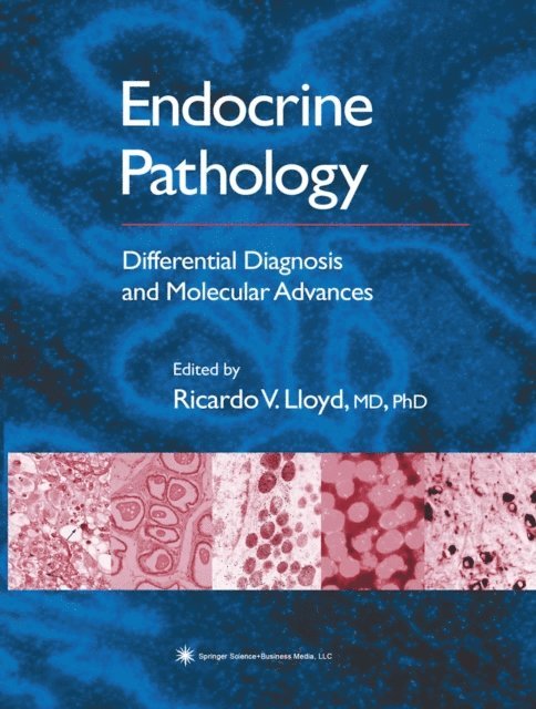 Ricardo V. Lloyd - Endocrine Pathology, E-bok