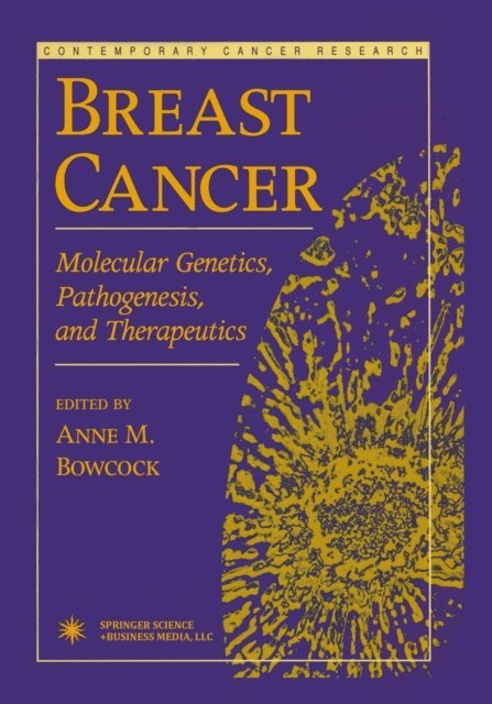 Anne M. Bowcock - Breast Cancer, E-bok