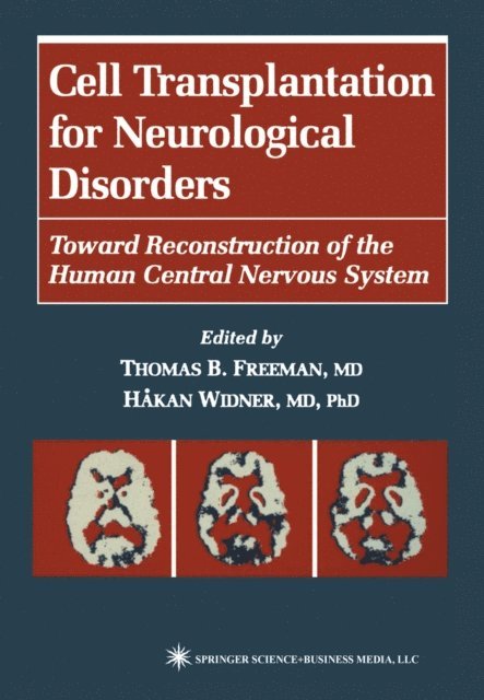 Hakan Widner, Thomas B. Freeman - Cell Transplantation for Neurological Disorders, E-bok