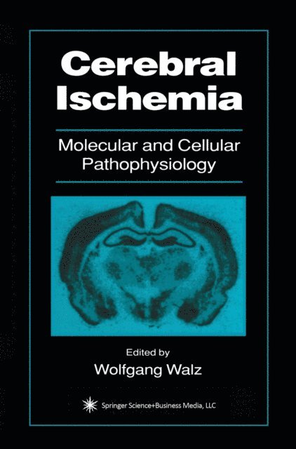 Wolfgang Walz - Cerebral Ischemia, E-bok