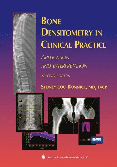 Sydney Lou Bonnick - Bone Densitometry in Clinical Practice, E-bok