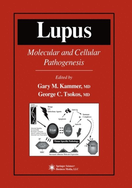 Gary M. Kammer - Lupus, E-bok