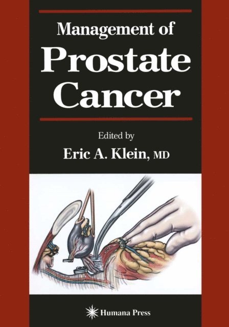 Eric A. Klein - Management of Prostate Cancer, E-bok