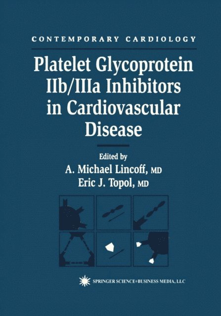 A. Michael Lincoff - Platelet Glycoprotein IIb/IIIa Inhibitors in Cardiovascular Disease, E-bok