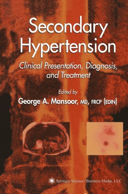 George A. Mansoor - Secondary Hypertension, E-bok
