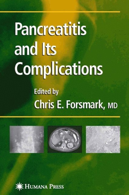 Chris E. Forsmark - Pancreatitis and Its Complications, E-bok
