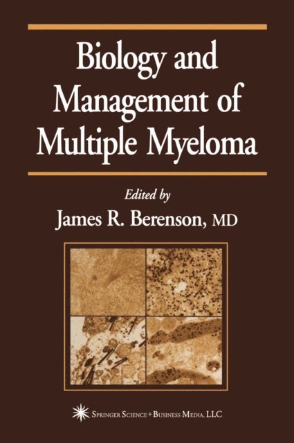 James R. Berenson - Biology and Management of Multiple Myeloma, E-bok